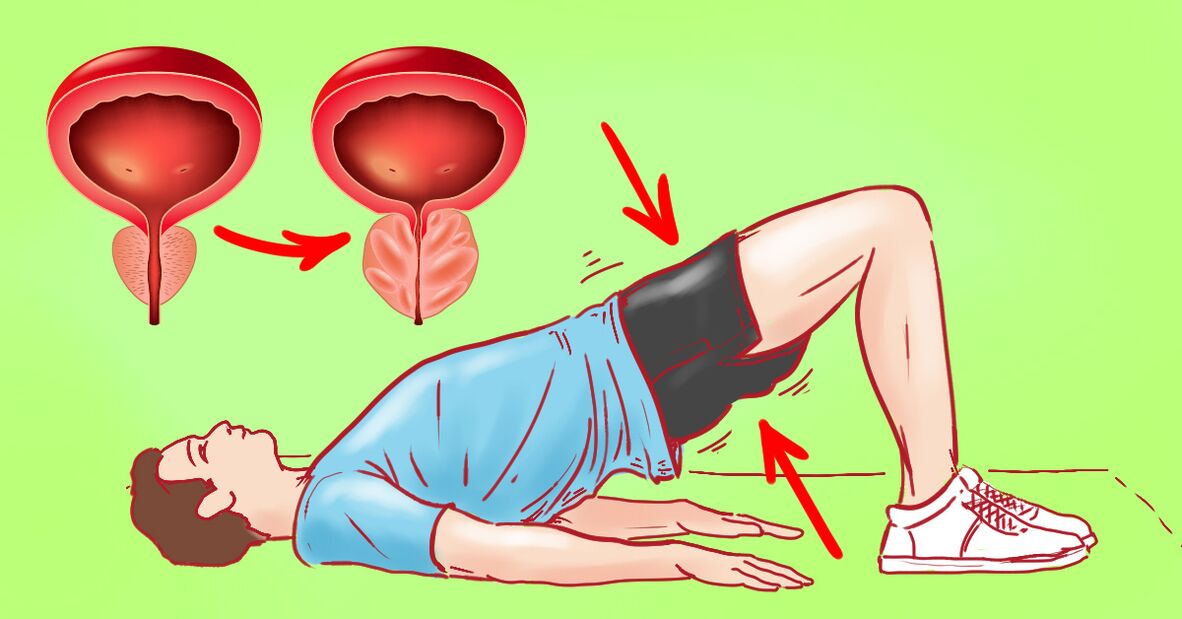 Exercicios terapéuticos en prostatite crónica