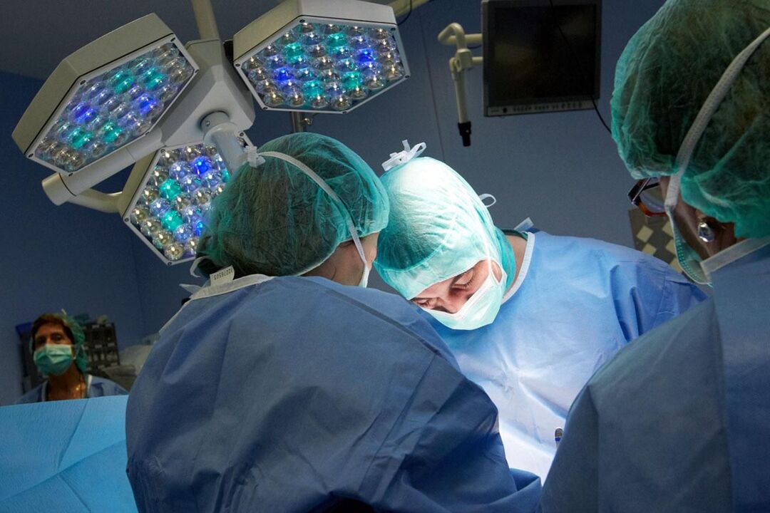 Operación en prostatite crónica