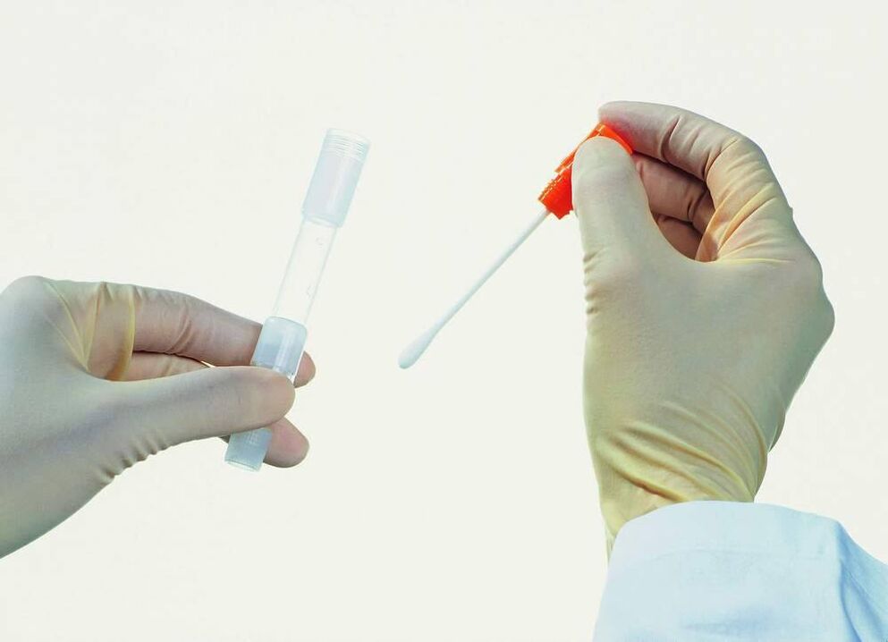 Recollida de análises para a detección de prostatite crónica