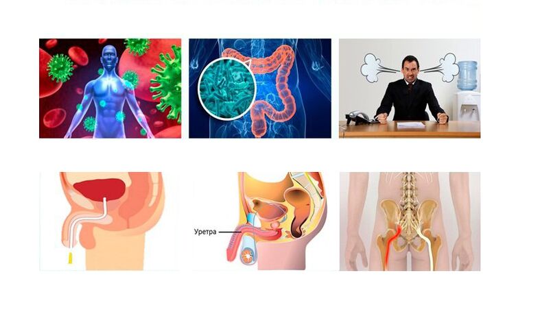 Causas da prostatite